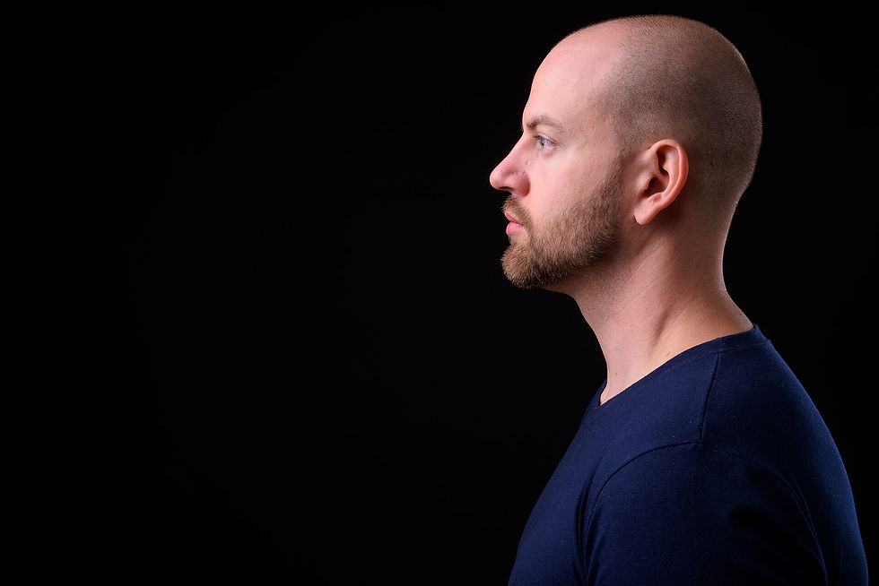 Bald man in profile contemplating hair restoration treatment options