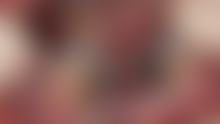 Immediate implant placement using Neo NaviGuide in the mandible anterior site