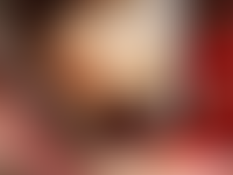 Management of an advanced periimplantitis