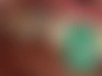 Intraoral Scanning System using a Scanbody