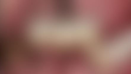 Implant placement with IS III active fixtures in the posterior mandible