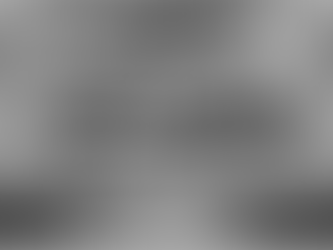 Early placement of the Neobiotech IS II Implants on the maxillary posterior area