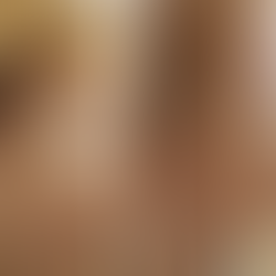 Daxxify injections Bozeman, MT