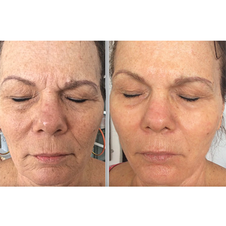 Wild Embers injector, Bozeman