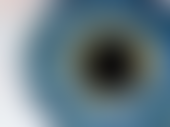 An Eye on Cataracts