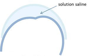 LENTILLE SCLERALE SOLUTION SALINE.png
