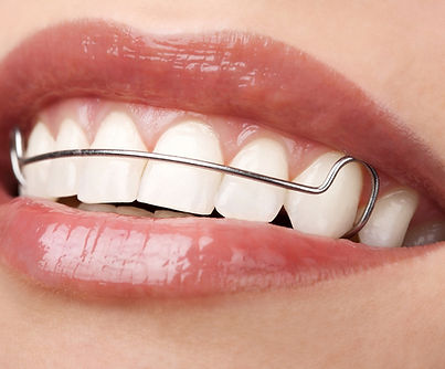 retainers.jpg