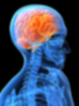Brain.jpg