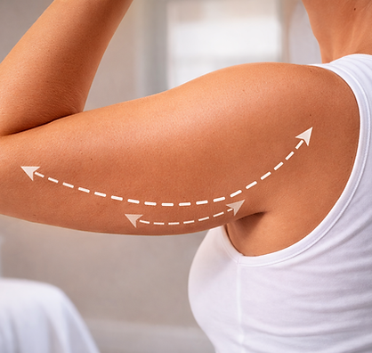 armlift.png