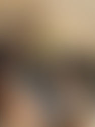 James Tyler Solen White Cap Swap.