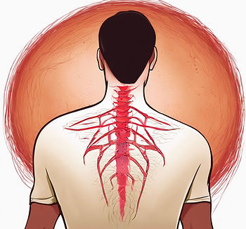 herpes zoster on the back.jpg