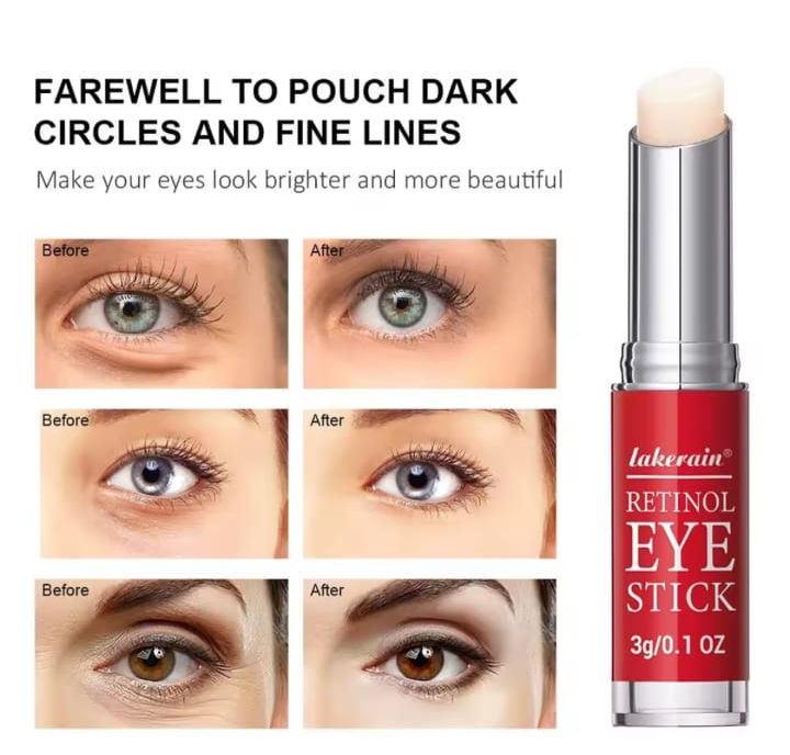 Thumbnail: Retinol Eye Cream