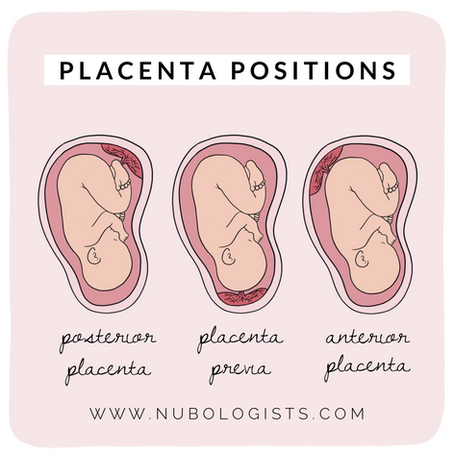 Placenta Positions