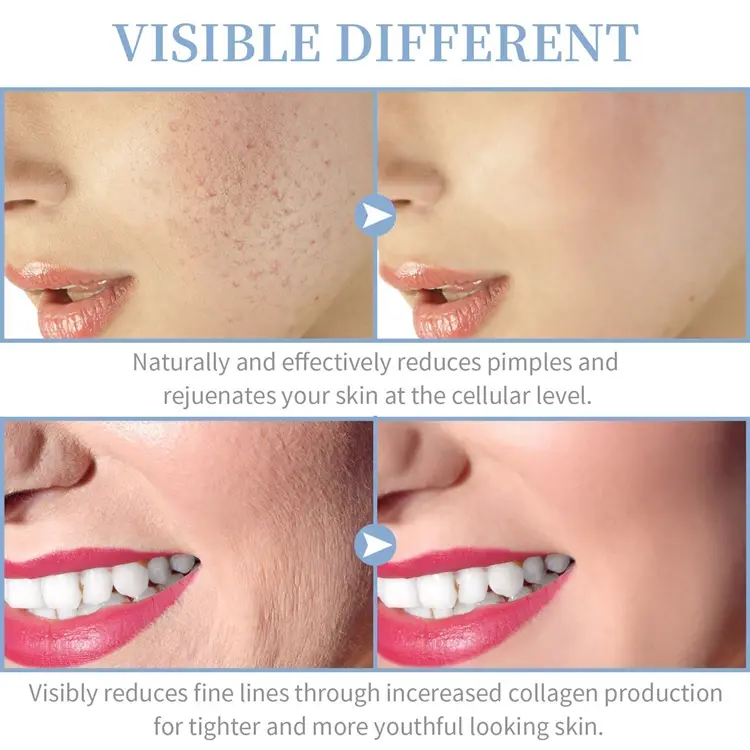Thumbnail: 4-in-1 Portable High-Frequency Facial Wand