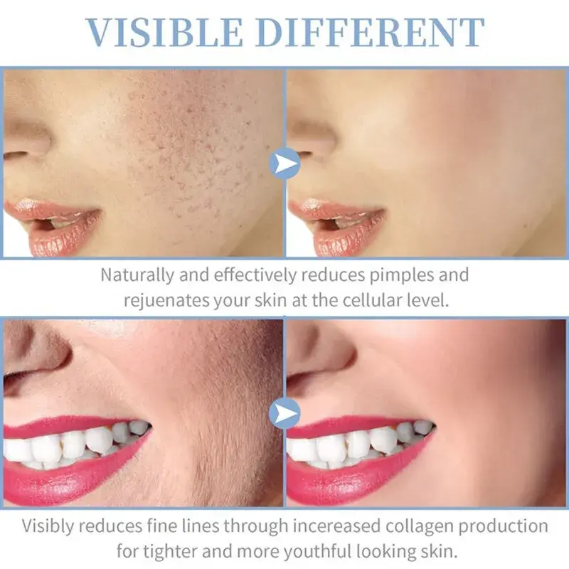 Thumbnail: 4-in-1 Portable High-Frequency Facial Wand