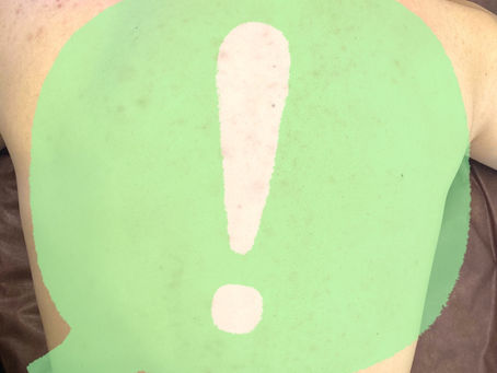 シェービングビフォーアフター😲✨