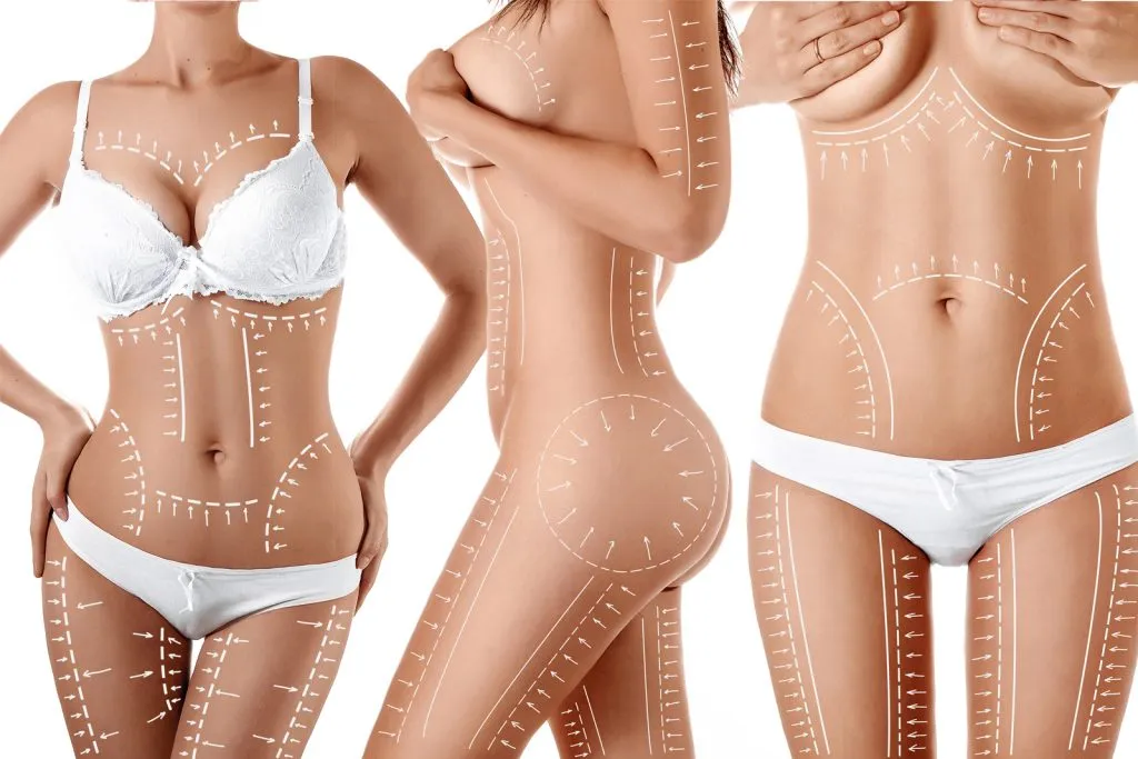 Liposizione e liposcultura Albania Doctor