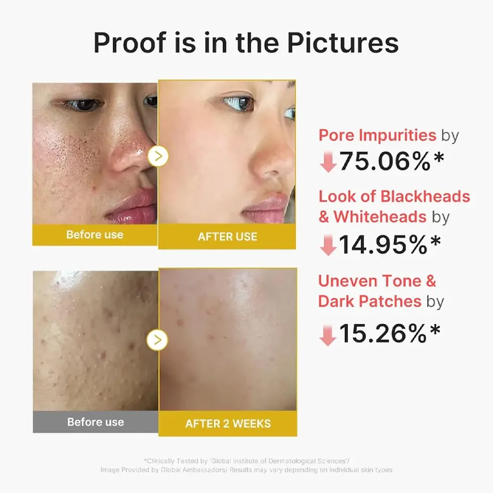 Thumbnail: Medicube - Kojic Acid Turmeric Peel Shot 80ml