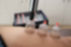Cupping therapy at Physioqinesis thane
