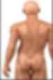 image showing scoliosis