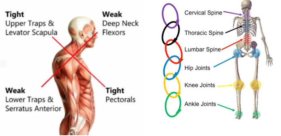 an image of a man explaining upper cross syndrome
