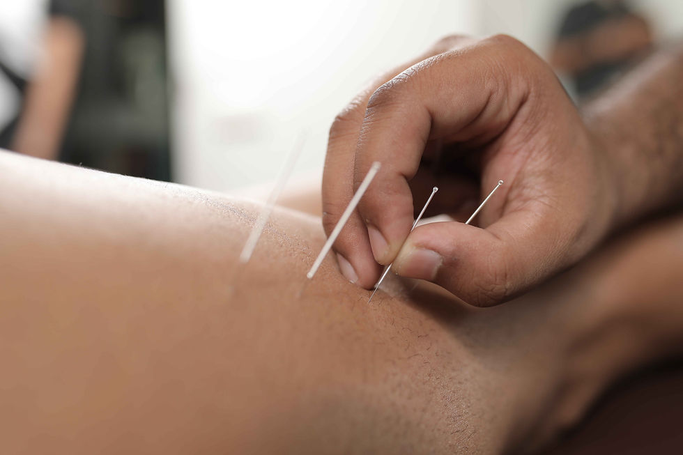 Dry Needling