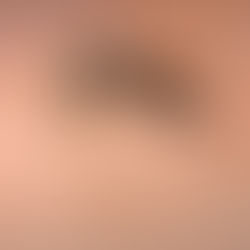 기후재난리포트12 ⑦ 기후질병 | 기온 1도 오르면 모기는 500㎞를 이동한다