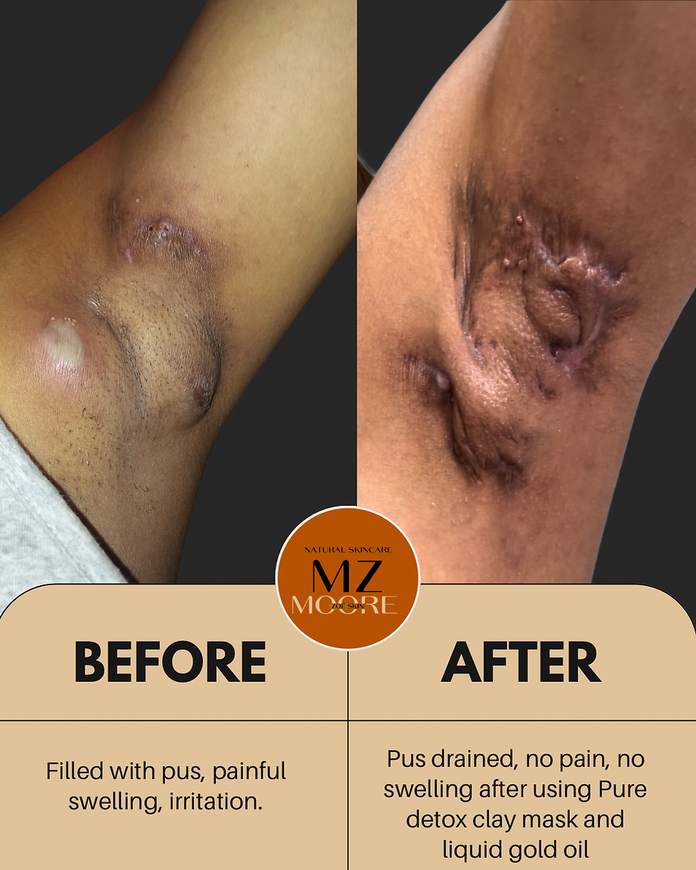 Orange and Beige Minimalist Skincare Before After Collage Instagram Post 3