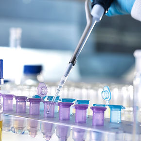 Laborpipetten und Fläschchen