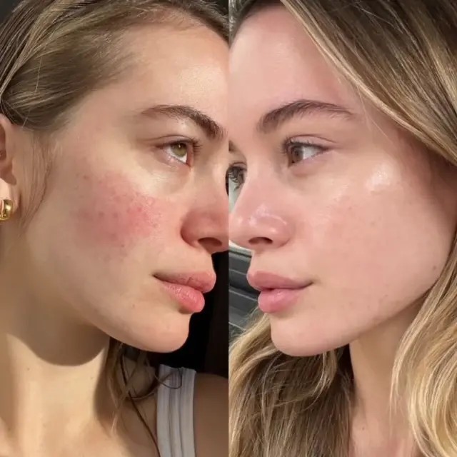 Thumbnail: Illuminate & Hydrate Liquid Vitamin Supplement