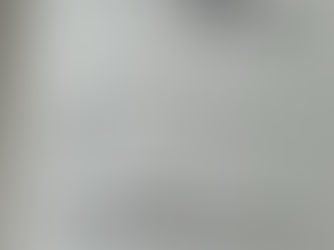 ◆転倒時に多い「コーレス骨折」