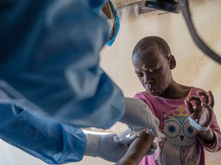 Moçambique reforça testagem local para conter surto de mpox no Niassa
