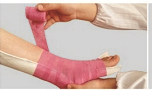 Polymer Splint