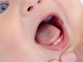 Unveiling the Importance of Primary Teeth in Infants