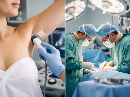 Ganglio centinela vs disección axilar: qué cambia