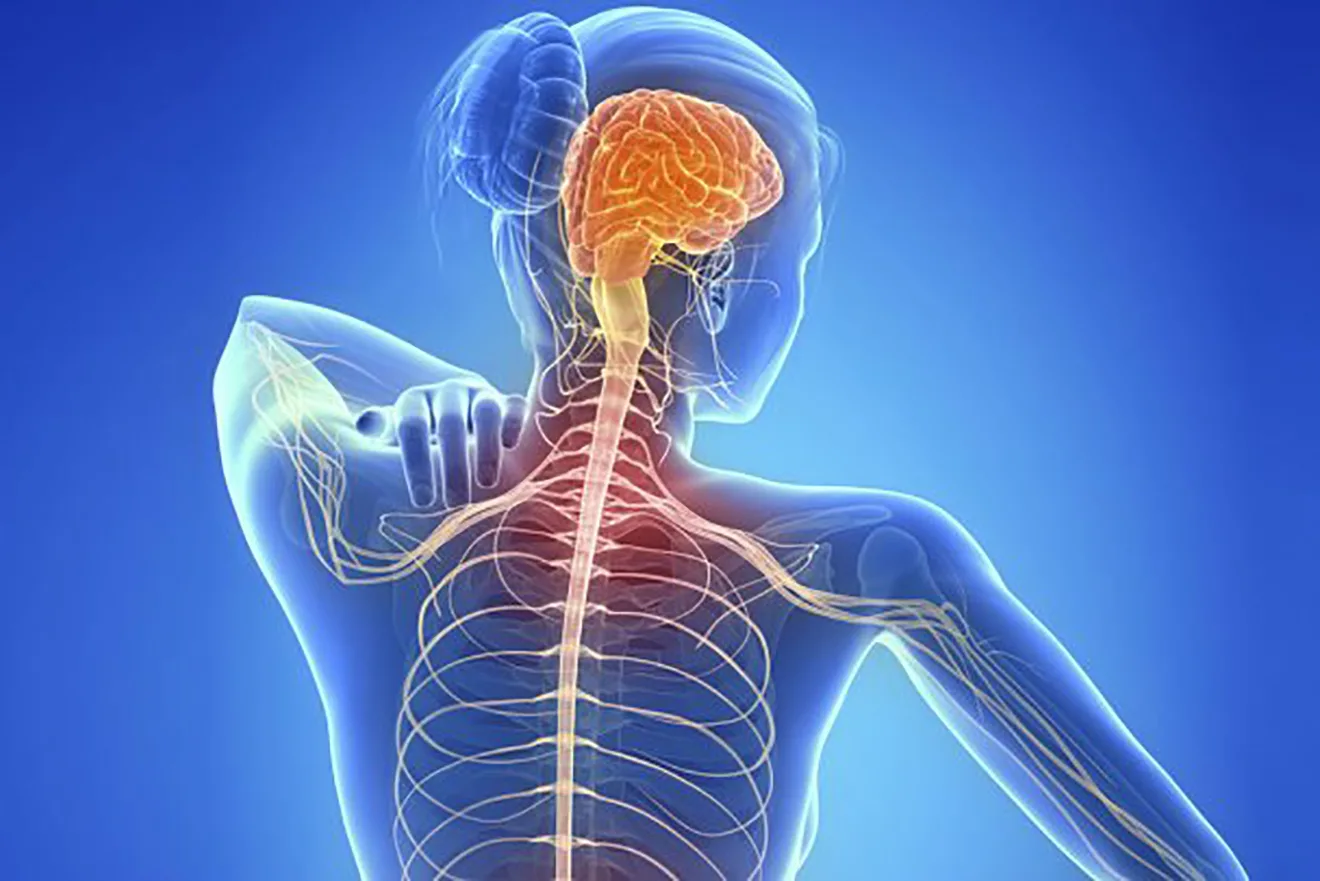EM - Esclerose múltipla desenho representando