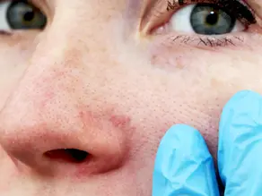 Understanding Pigmentation and How to Brighten Your Skin