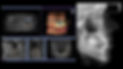 3D Digital Dentistry Buckhead Dentists