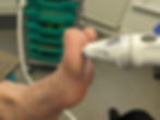 Swift applicator tip gently applied to left big toe