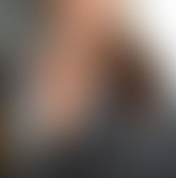 PCOS Hair Fall Solutions: Honest Guidance From One Woman to Another