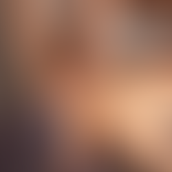 Chấn thương cơ Trap do vận động thể thao và giải pháp Sport Massage hiệu quả