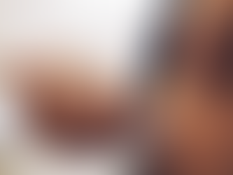 REMÉDIO PARA DIABETES E OBESIDADE PODE ELEVAR RISCO DE CEGUEIRA RARA, DIZ ESTUDO