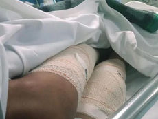 MENINO É ATACADO POR PITBULL EM SÃO JOSÉ DOS CAMPOS