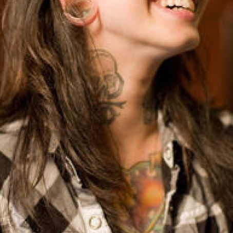 Preguntas frecuentes II: ¿Qué necesitas saber sobre la eliminación láser de tatuajes?