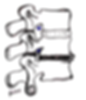 Espondiloartrosis lumbar