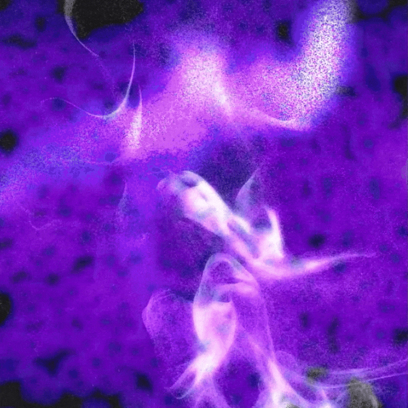 ezgif.com-overlay (1).gif