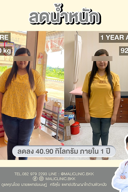 MALI CLINIC SILOM 3 ลดน้ำหนัก ดูแลรูปร่าง