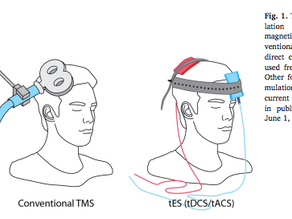 What is TMS and can it help treat withdrawal, addiction and depression?