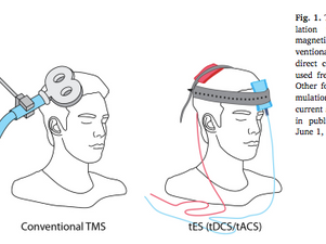 What is TMS and can it help treat withdrawal, addiction and depression?