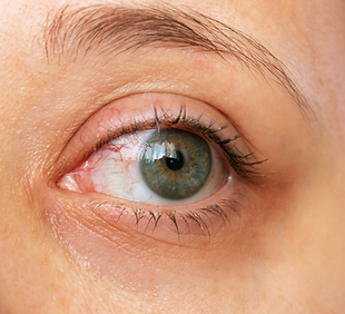 Untitled design-2 copy 3.png